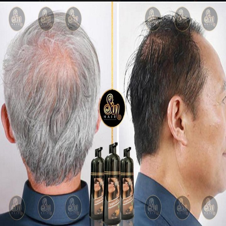 Dầu gội Phủ Bạc Nhân Sâm Sin Hair - hinh 06