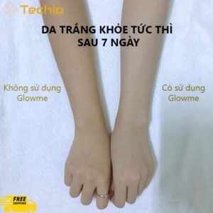 Kem dưỡng trắng da Glowme - eshopkhoedep09