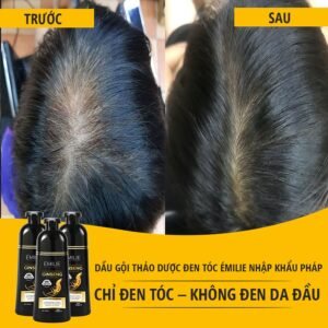 Dầu Gội Phủ Bạc Émilie Từ Pháp - hinh 07