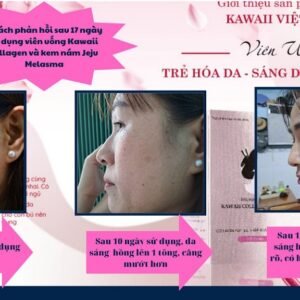 Viên Uống Sáng Da Kawaii Collagen Secret - H07