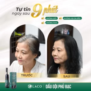 Dầu gội phủ bạc Laco - hinh 05