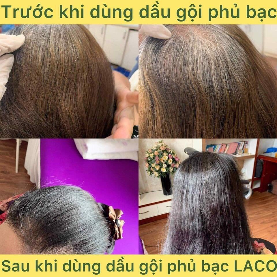 Dầu gội phủ bạc Laco - hinh 06