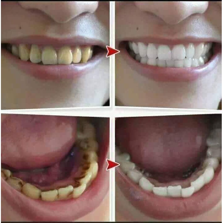 Bột trắng răng Dạ Thảo Liên - hinh 04