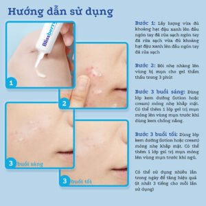 Gel bôi trị mụn Blissberry Pureskin Acne Fixer K21 - hinh 08
