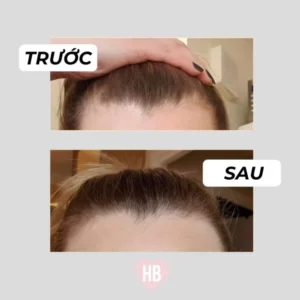 Set Gội Xả HAIRBURST Kích Thích Tóc Mọc Dài Hơn - hinh 05