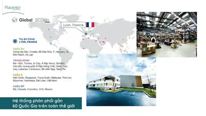 Hệ thống phân phối trên toàn cầu